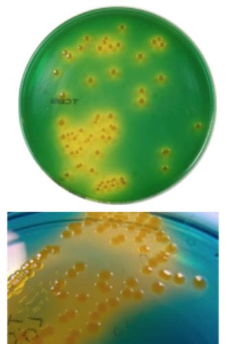 Campylobacter Helicobacter Vibrio Flashcards Quizlet