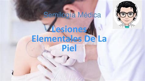 Lesiones Elementales Dermatolog A Udocz The Best Porn Website