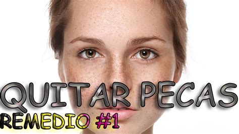 Pecas Remedios Caseros Para Quitar Las Pecas Como Quitar Las Pecas