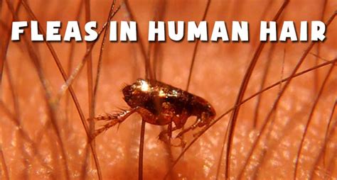 Can Cat Lice Live In Human Hair Jenise Salinas