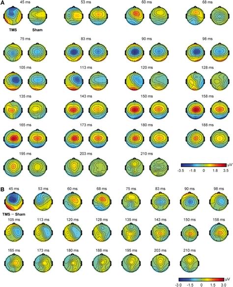 Scalp Topographies Obtained From Real TMS And Sham Conditions Real TMS