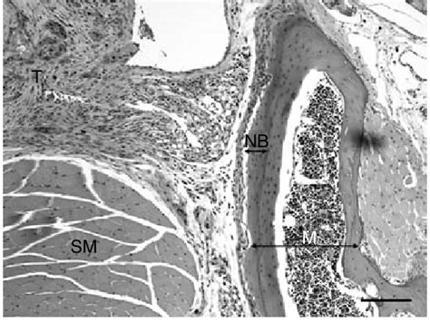 Histopathology Of Sccf110yfpluc Tissue Xenograft Solid Tumour Was