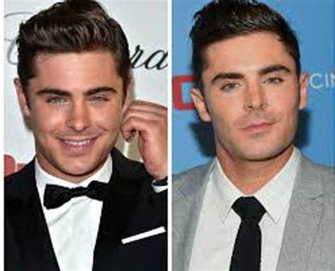 Zac Efron Plastic Surgery Nose Job The Curious Case Of His Rhinoplasty