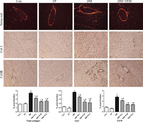 Representative Images Of Sirius Red Staining For Total Collagen And