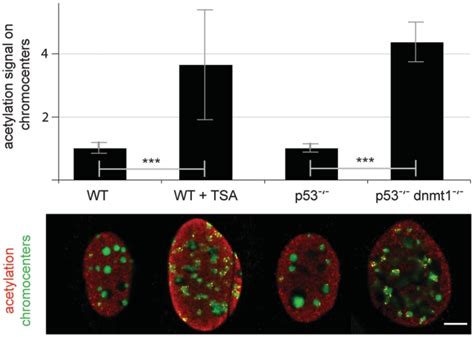 Dnmt Have Increased Levels Of Histone Acetylation At Chromocenters