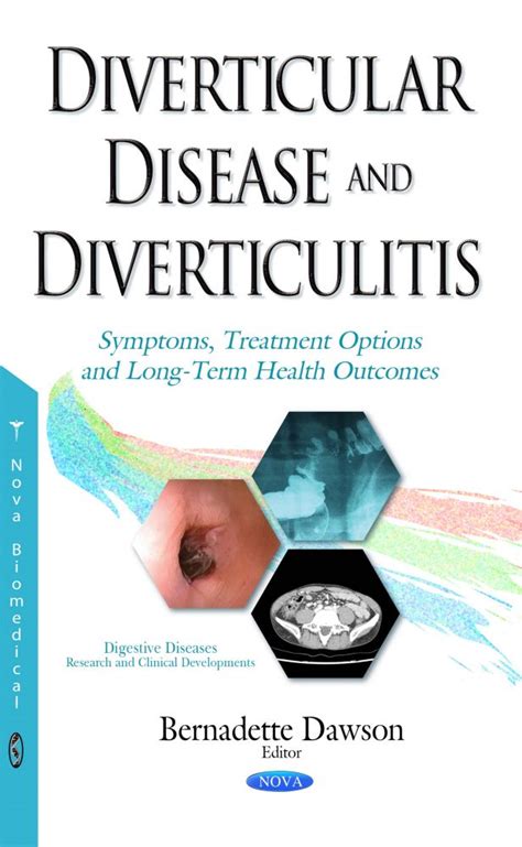 Diverticular Disease Causes Diagnosis And Treatment 54f