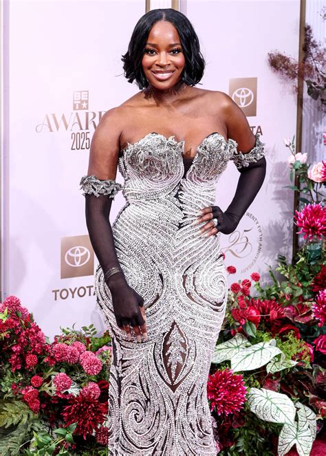 PHOTO: RHOA’s Shamea Morton Shows Graphic Injuries From Chemical Peel