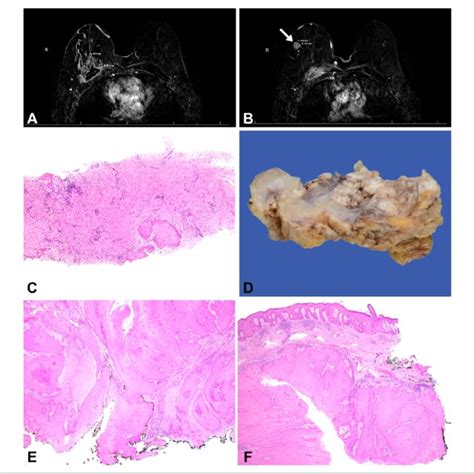 Magnetic Resonance Imaging Mri Macroscopic And Microscopic Features