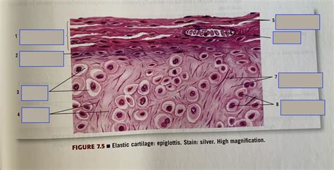 identify elastic cartilage components Diagram | Quizlet