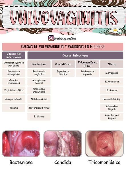 Vulvovaginitis Alicia En Medicina By Gabriela Soplin Villacorta UDocz