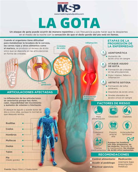 La gota Infografía