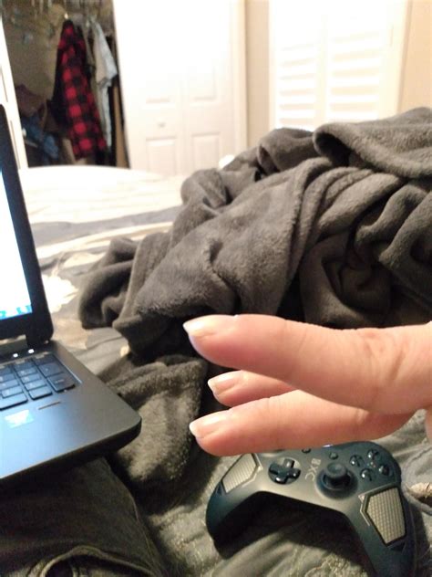 Does my index finger look like it's clubbing? : r/medical