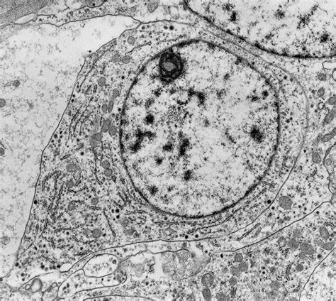 Célula Vista De Uma Microscópio Eletrônico Microscópio Eletrónico Microscópio óptico Imagens