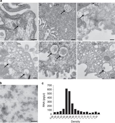 Nucleic Acids Within Urinary Exosomes Microvesicles Are Potential