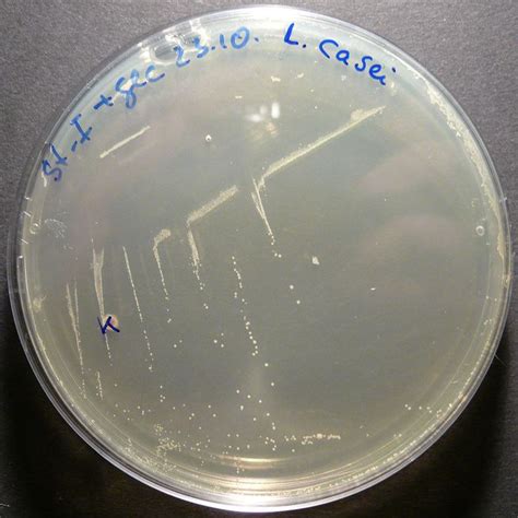 Lactobacillus Casei Alchetron The Free Social Encyclopedia