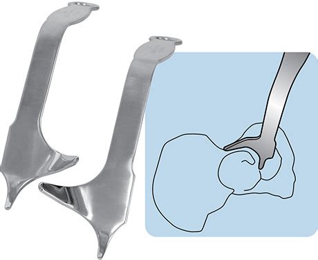 Innomed Hip Instruments Extra Large And Extra Long Retractors