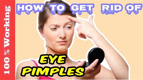 How To Get Rid Of Pimples On Eyelids Overnight Fast Home Remedies Blackheads Acne