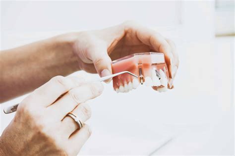 Are Dental Implants Right For Me Austin Laser Dentist Helen