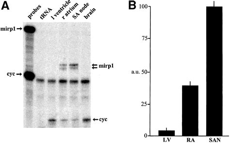 MinK Related Peptide 1 Circulation Research