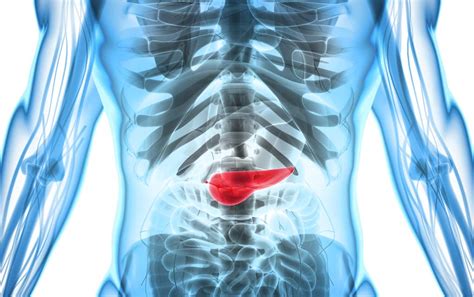 5 Early Warning Signs of Pancreatic Cancer