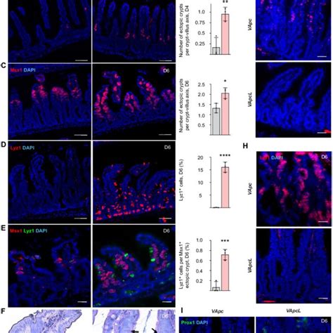 Lef1 Deletion Increases Tumor Initiation And Growth In Apc Mutant