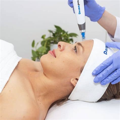 Dermapen 4 Microneedling Treatment Satini Cosmetic Clinic