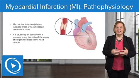 Myocardial Infarction Mi Pathophysiology Med Surg Nursing