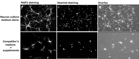 Neuron Culture Medium For Those Having Difficulties With Primary