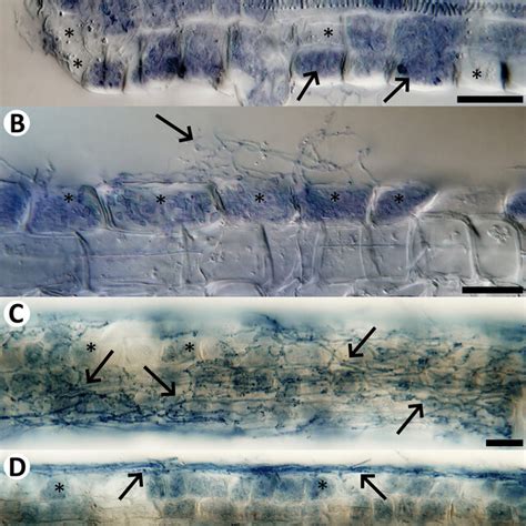 Natural Fungal Colonization In Hair Roots Of Vaccinium Myrtillus From