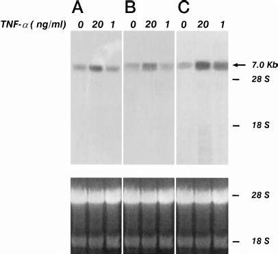 Effect Of TNF On VEGFR 2 MRNA Expression In Human Endothelial Cells