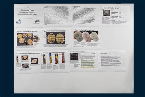 ScholarSpace @ JCCC - JCCC STEM Poster Symposium: Digging for Cures