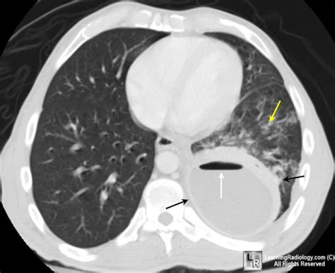 Learningradiology