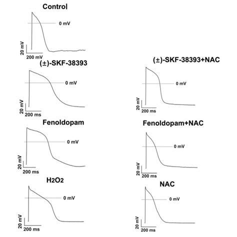 ROS Mediated The Effects Of SKF 38393 Or Fenoldopam On Action