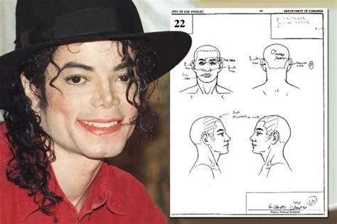 Michael Jackson Autopsy Photo Face