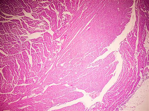 Smooth Muscle Tissue Stock Photos Pictures And Royalty Free Images Istock