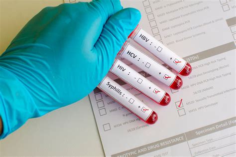 Private Sexual Health Testing Sti Testing Privatemedicalclinic