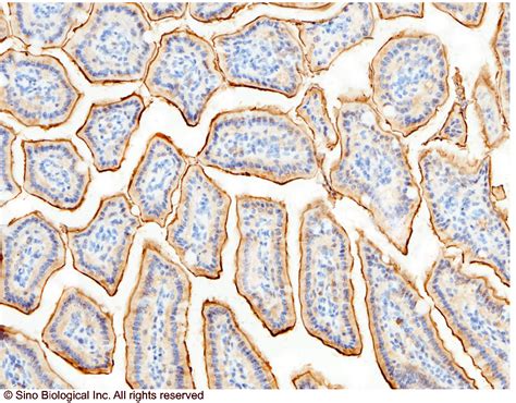 recombinant anti cd antibody rabbit mab   sino biological