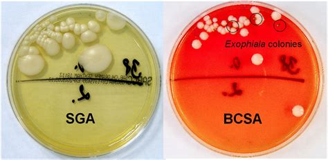 Burkholderia Cepacia Selective Agar Can Be Useful For Recovery Of