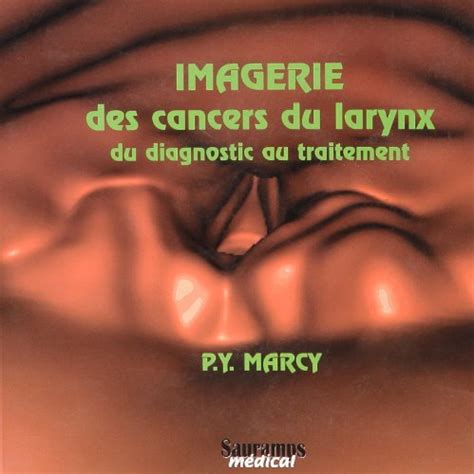 Imagerie Des Cancers Du Larynx Du Diagnostic Au Traitement Marcy