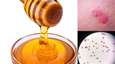 Natural Honey For Yeast Infection Bharat Honey