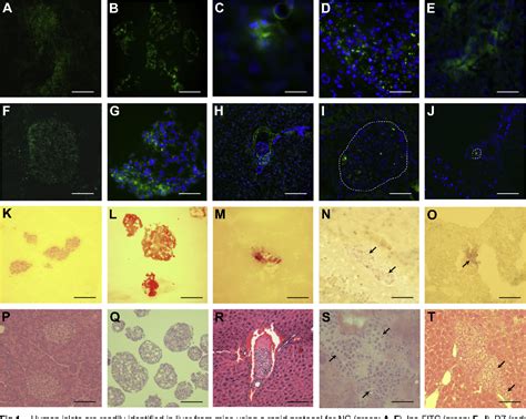 Figure 1 From Assessment Of Human Islet Grafts In Frozen Sections Of CD