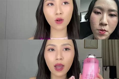 Capek Bruntusan Nggak Ilang Ilang Beauty Vlogger Ini Buktikan Skincare