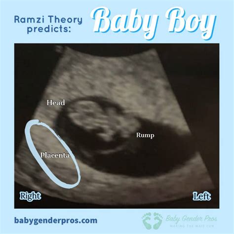 Metodo Ramzi Semana A Semana Baby Gender Pros