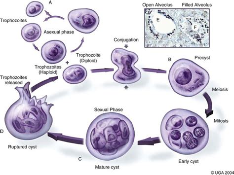 Pneumocystosis Veterian Key