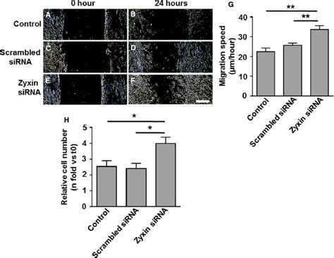 Transient Silencing Of Zyxin By Sirna Promotes Migration And