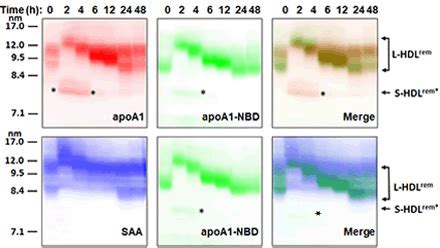 Abstract Csl Apolipoprotein A I Human Infusion Rapidly