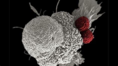 Why Do Only Certain Brain Tumors Respond To Immunotherapy Technology