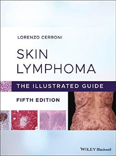 Skin Lymphoma The Illustrated Guide 5Th Edition – Hacasa Shop