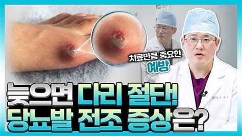 공포의 당뇨합병증 당뇨발 🦶｜제때 발견·치료하지 않으면 다리 절단해야 한다 😨 Youtube