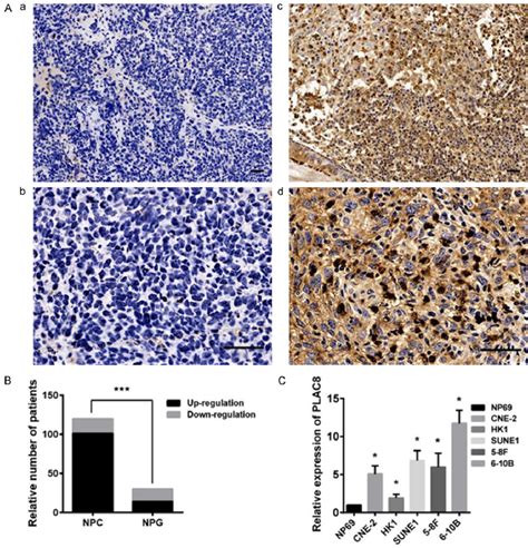 Expression Of The Plac8 Protein In Npc Tissues And Plac8 Mrna In Npc